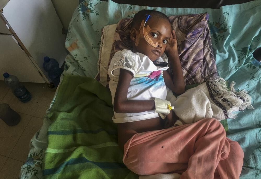 Genet Mehari treated for malnutrition.jpeg